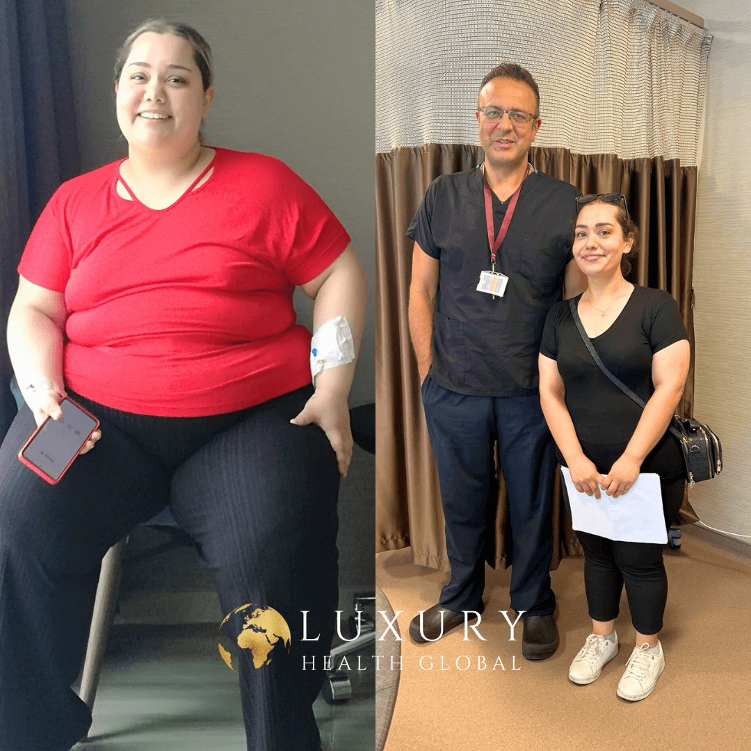 Obesity Surgery - 1 Yıllık Sonuç, 42 kg Kayıp Öncesi